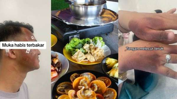 5 Kecelakaan Tragis Dialami Orang Saat Makan di Restoran