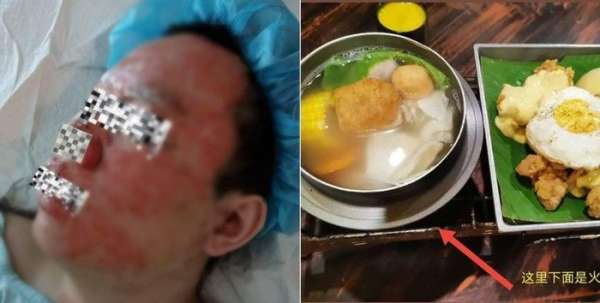 5 Kecelakaan Tragis Dialami Orang Saat Makan di Restoran