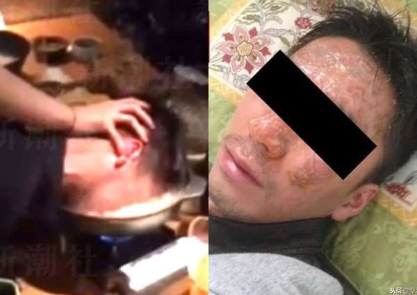 5 Kecelakaan Tragis Dialami Orang Saat Makan di Restoran