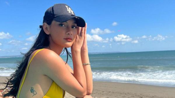Erika Carlina curhat didiagnosis idap autoimun