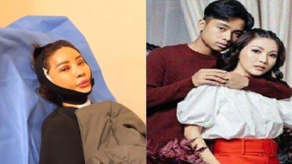 DIGUGAT Cerai Ruben Onsu, Sarwendah Jalani Operasi Plastik di Korea Selatan, Betrand Peto Diboyong