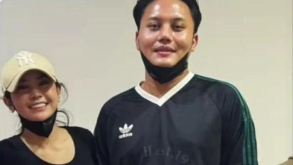 hidung Rizky Febian tampak sangat mancung sehingga ada yang menuding anak