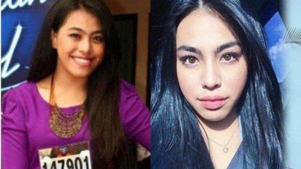Nasib juara 2 Indonesian Idol tinggalkan Tanah Air, sempat idap kista.