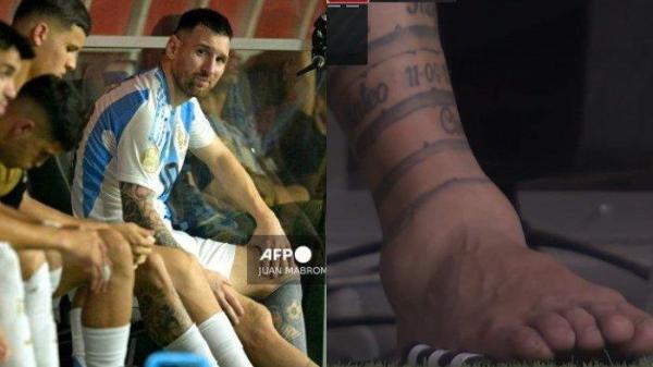 Penampakan ankle kanan Lionel Messi yang bengkak saat laga final antara Argentina vs Kolombia di final Copa America 2024, Senin (15/7/2024).