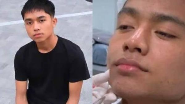 Betrand Peto berani filler dagu.