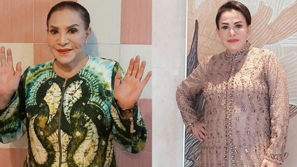 Mpok Atiek pernah gagal oplas