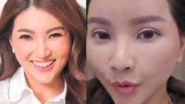 Potret Sarwendah istri Ruben Onsu yang melakukan oplas wajah di Korea Selatan.