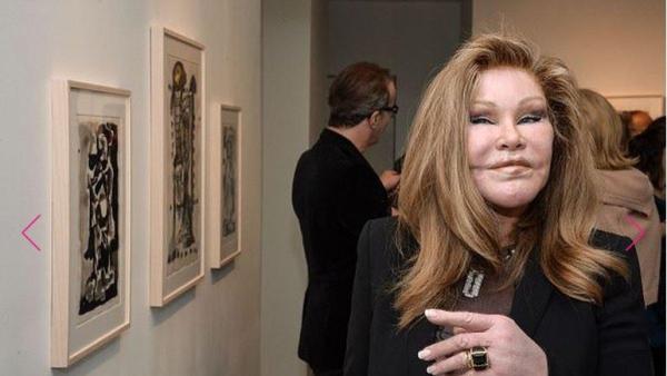 Jocelyn Wildenstein disebut pernah mengalami kebangkrutan.
