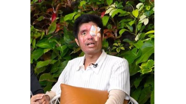 Muhammad Agus Salim menjadi kroban penyiraman air keras yang diduga dilakukan rekan kerjanya sendiri.