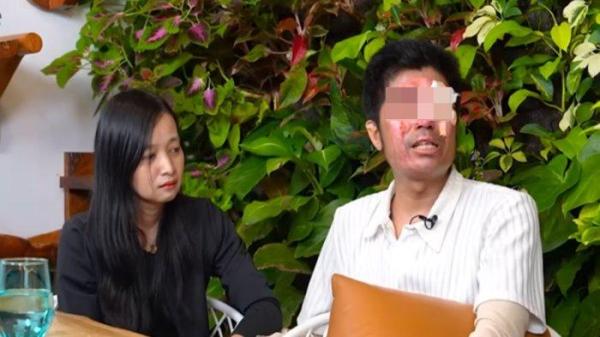 Muhammad Agus Salim, korban yang disiram air keras tak kuasa menahan tangis mengungkapkan kejadian yang dialaminya.