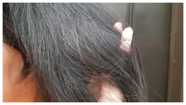 Ilustrasi rambut rusak karena sering tidur dalam keadaan rambut basah.