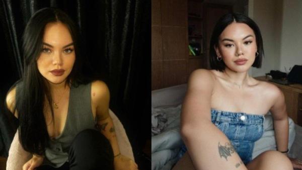 Shafa Harris jalani oplas di Korea Selatan.