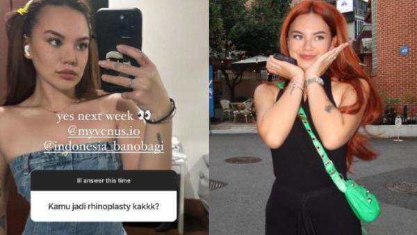 Shafa Harris jalani oplas hidung di Korea Selatan