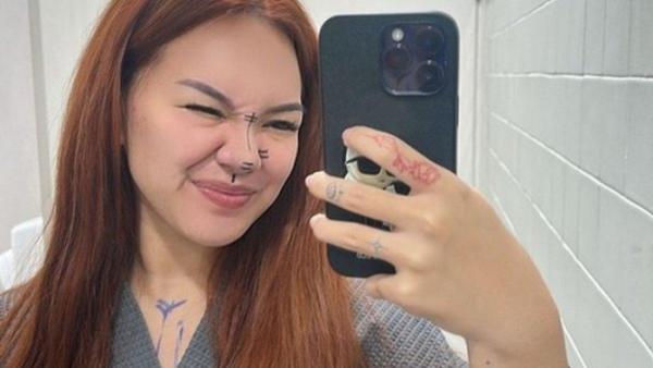 Shafa Harris jalani oplas hidung dengan mengambil sebagian tulang iga dari tubuh