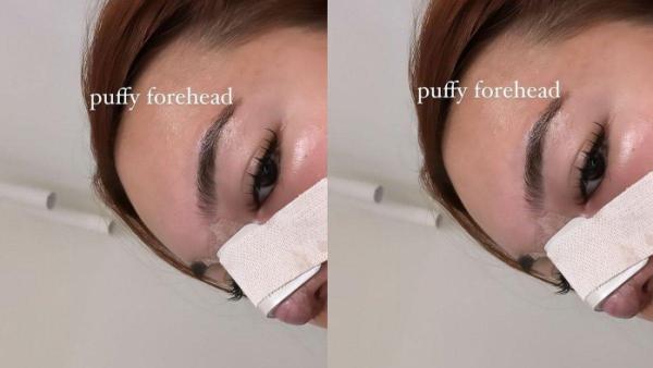 Shafa Harristak sabar lihat hasil oplasnya