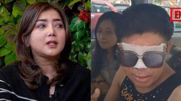 HEBOH Akun Instagram Novi Hilang Imbas Kisruh Donasi Agus Salim, Kini Minta Maaf dan Klarifikasi