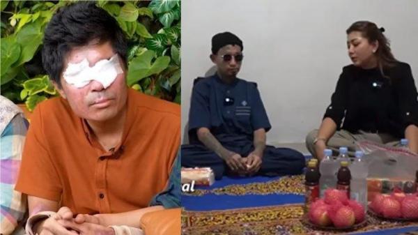 Tempuh jalan yang berbeda dengan Agus Salim (kiri), Icang (kanan) korban congkel mata alami keajaiban saat berobat