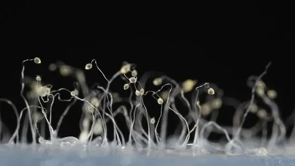 Salah satu contoh acrasiomycota adalah Dictyostelium discoideum.