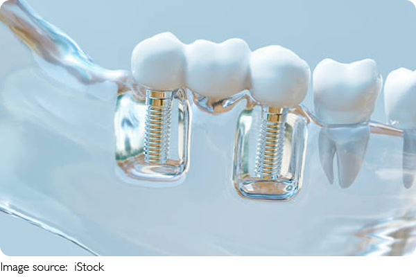 Truth of Wisdom Teeth!