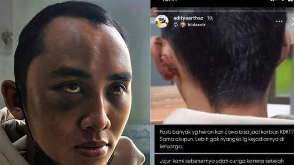 Kepala Dinas Pemuda dan Olahraga (Kadispora) Bandung Barat, Imam Santoso, membenarkan kalau Calvin (korban penganiayaan istri yang viral di media sosial) merupakan ASN atau PNS golongan III Dinas Pemuda dan Olahraga (Dispora) Kabupaten Bandung Barat, Jawa Barat. Imam Santoso mengatakan, Calvin bertugas di bagian aset Dispora.  (X)