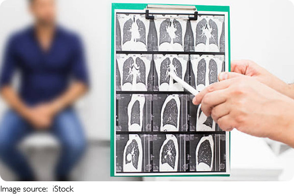 Triagem instantânea salva