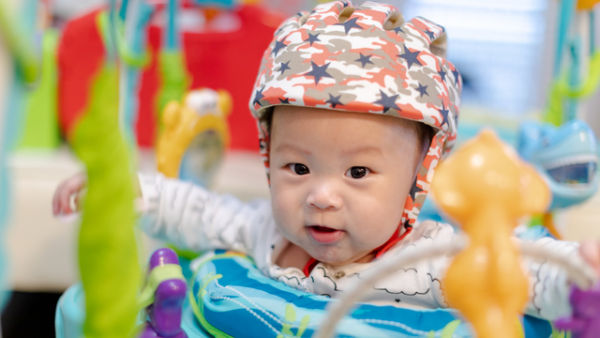 Helm perawatan kepala peyang pada bayi.
 Foto: Shutter Stock