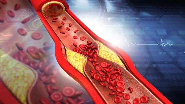 Controls cholesterol