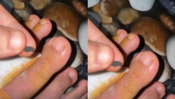 KABAR DIMAS AHMAD - Dimas membagikan kondisi yang kurang menyenangkan.