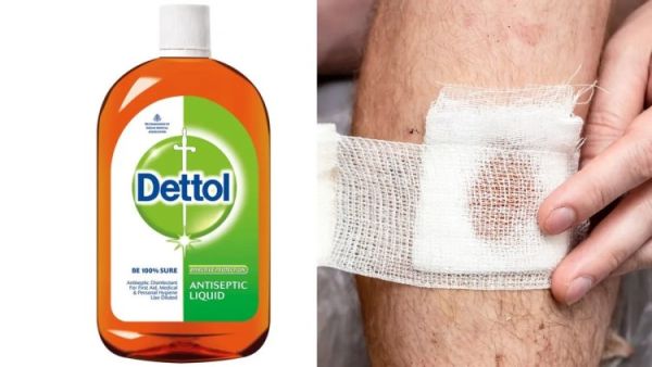 dettol for wounds safe or not 1744015607540