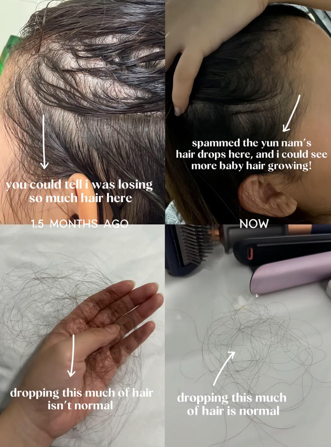 Sağlıklı ve Parlak Saçlar