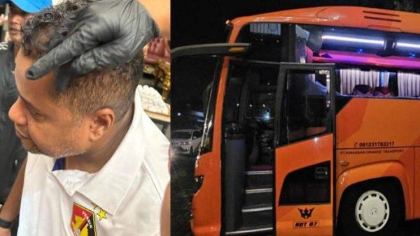 KORBAN - Pelatih Persik Kediri Divaldo Alves saat mendapatkan perawatan dari tim medis. Divaldo jadi korban insiden pelemparan batu terhadap bus yang ditumpangi tim Persik Kediri seusai berlaga menghadapi Arema FC di stadion Kanjuruhan Malang pada Minggu (11/5/2025) dan Kondisi Bus saat tiba di hotel di kawasan Kepanjen Malang.