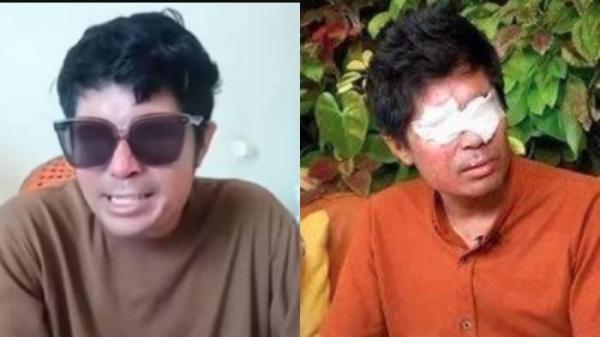 Agus Salim masih belum menjalani operasi dan tak dapat uang donasi