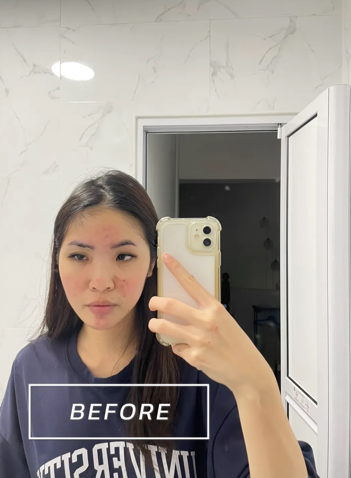 Face Freakout Or Fix Fast