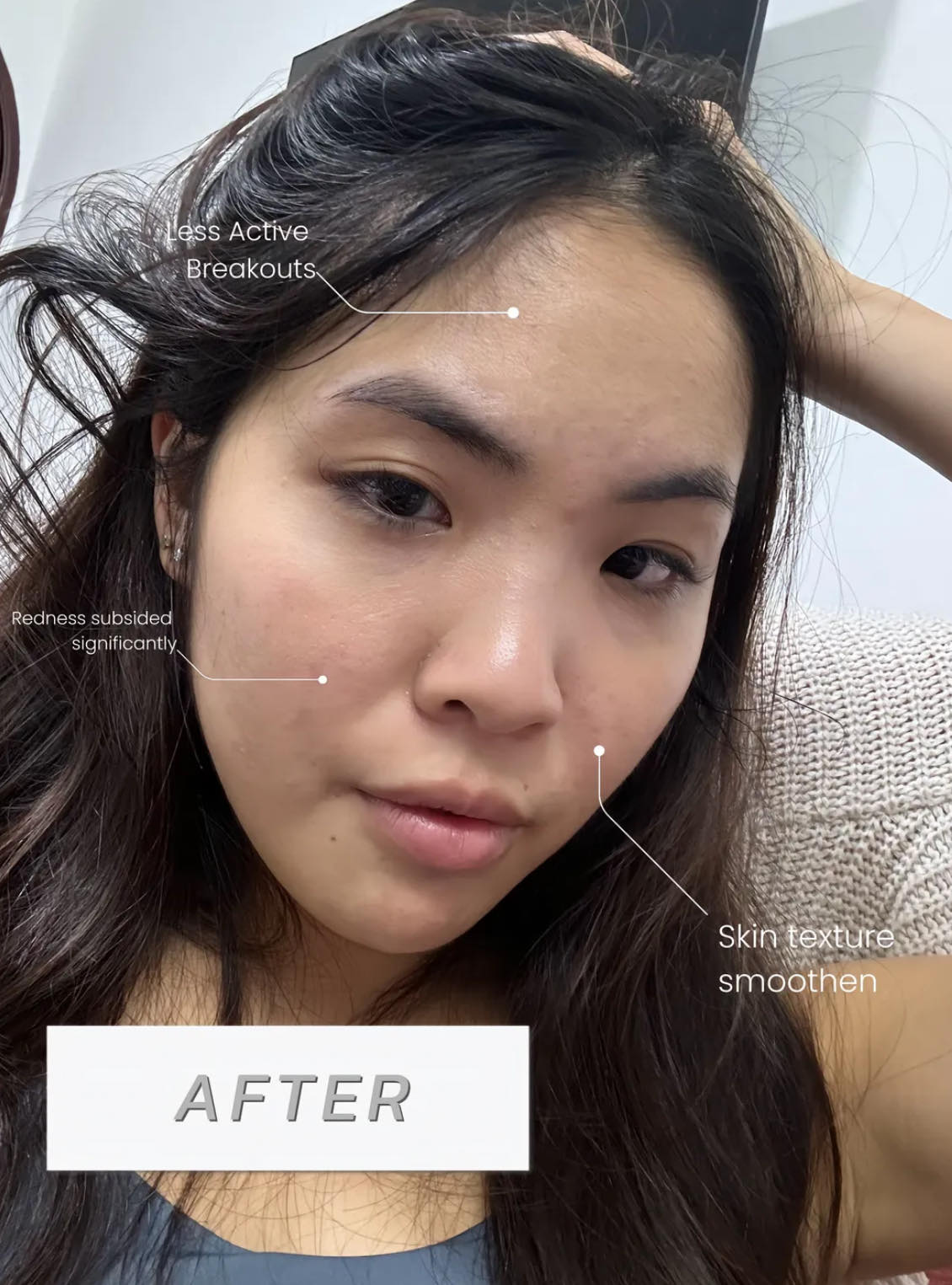 Face Freakout Or Fix Fast