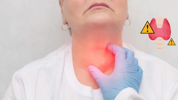 Hypothyroidism 1747209781484 1