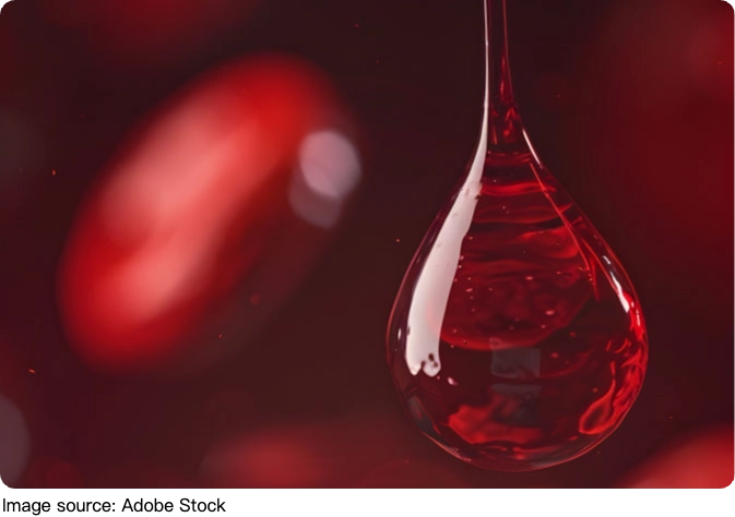 Leukocytosis & Leukopenia