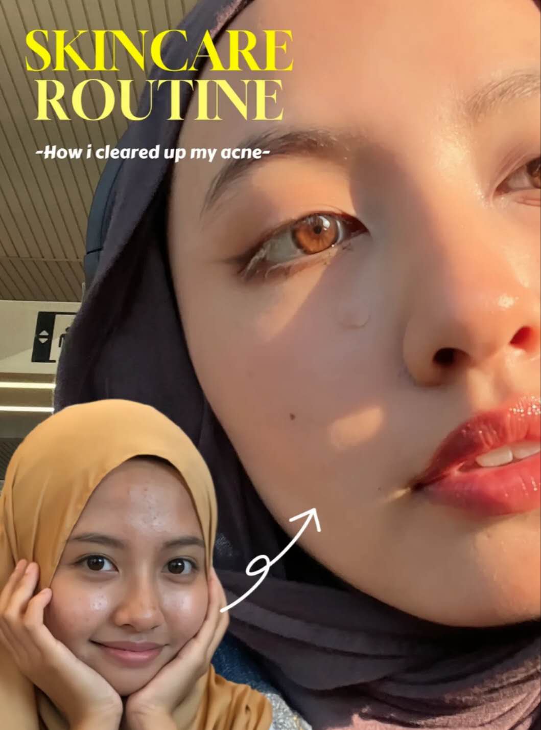 My Glow-Up Story!