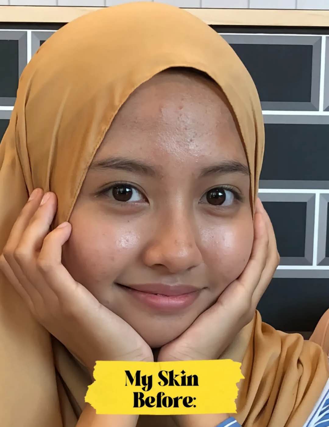 My Glow-Up Story!