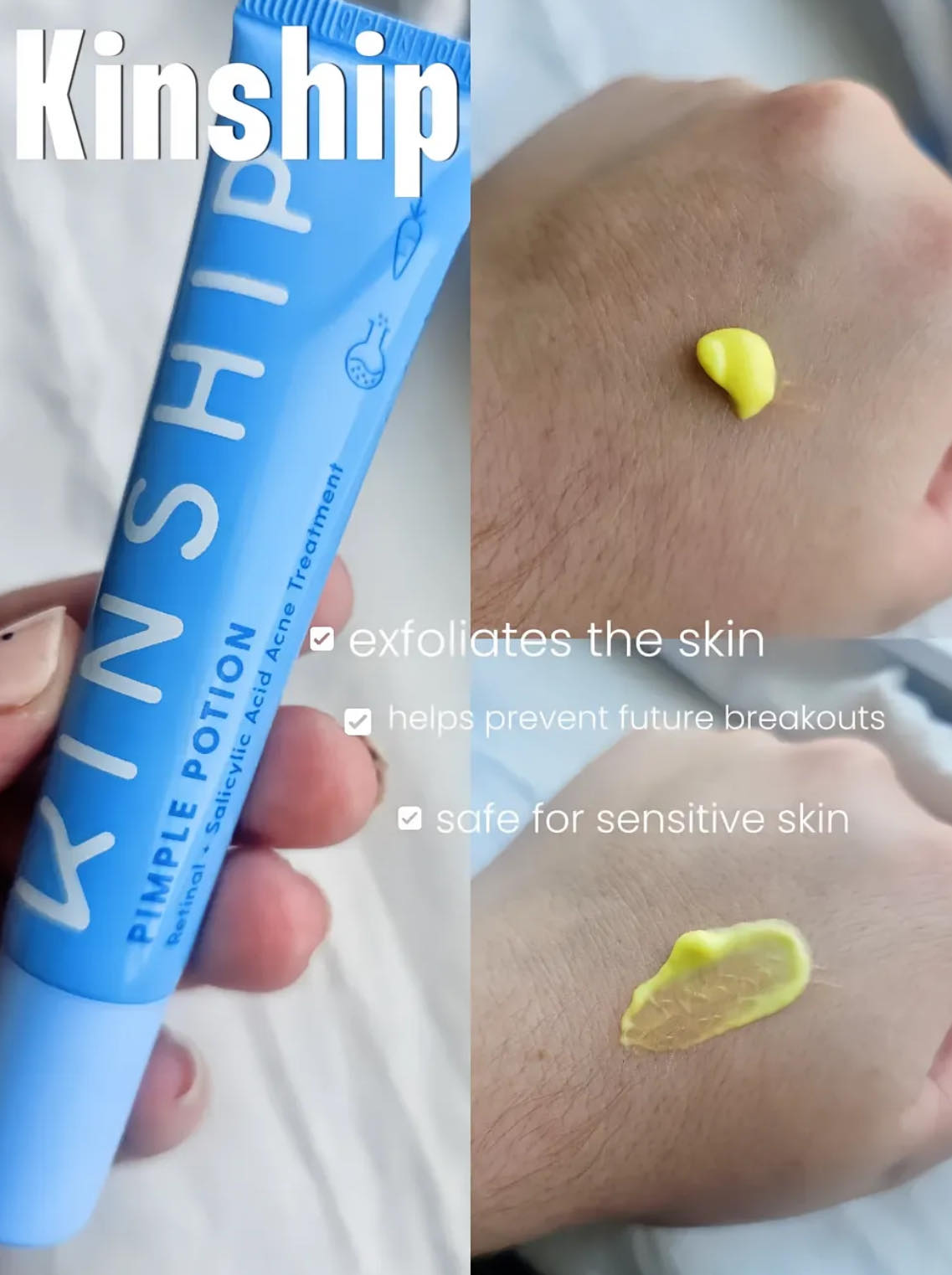 Fast Pimple Fix
