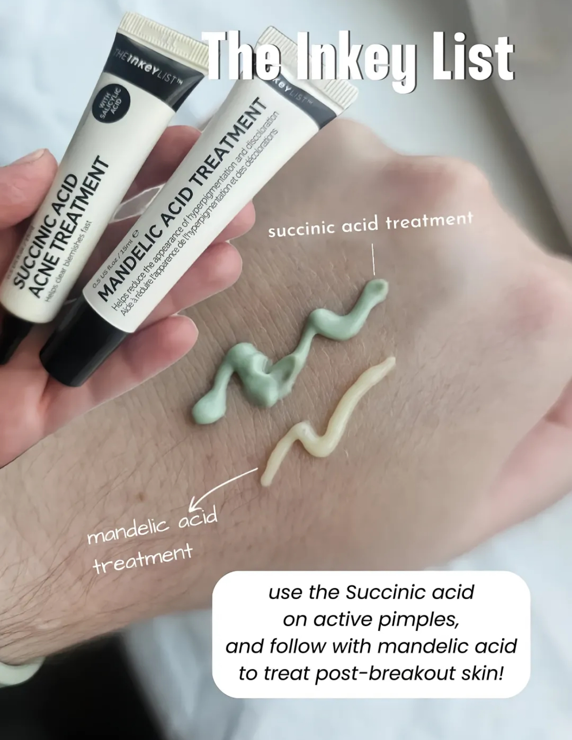 Fast Pimple Fix