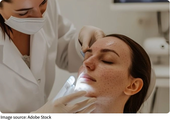 High Nose with Filler?