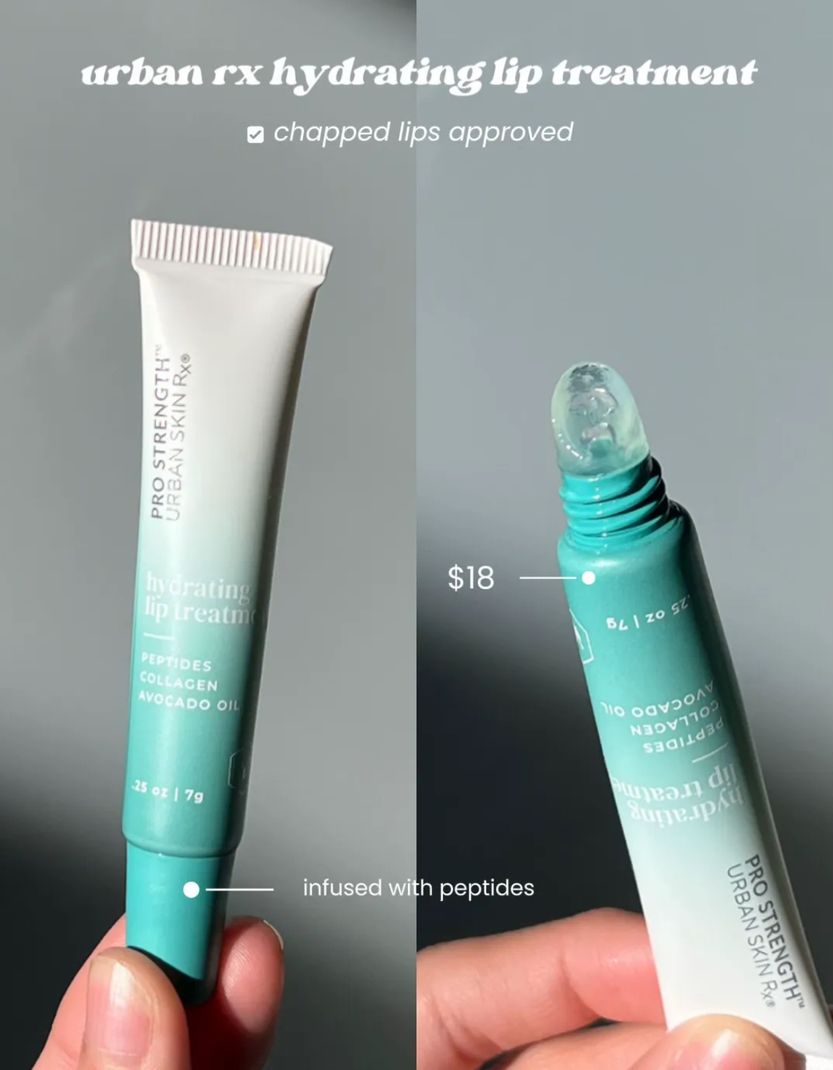 Top Lip Balms!