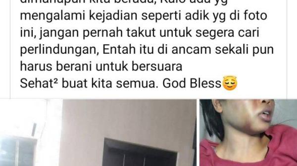 2206_BATAM_Korban Penganiayaan Majikan 1