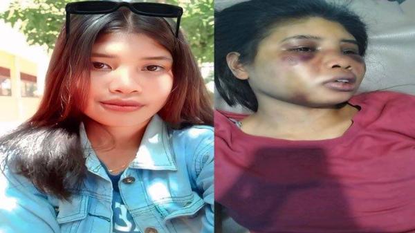ART DI BATAM KENA SIKSA MAJIKAN - Foto Intan, Asisten Rumah Tangga atau ART di Batam korban penganiayaan majikan sewaktu baru tamat SMA di Sumba Barat, Provinsi Nusa Tenggara Timur (kiri), dan foto Intan setelah kena siksa majikan (kanan).