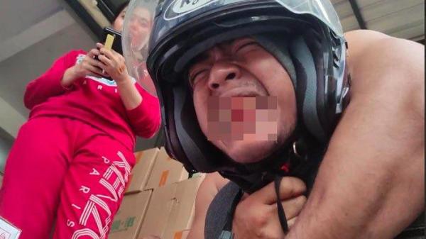 MENGERANG KESAKITAN - Wajah Irwan (kurir) saat lehernya dipiting oleh Arif terduga pelaku yang tak terima paket COD-nya tidak sesuai pesanan. Mulut korban sampai mengeluarkan darah akibat peristiwa itu.