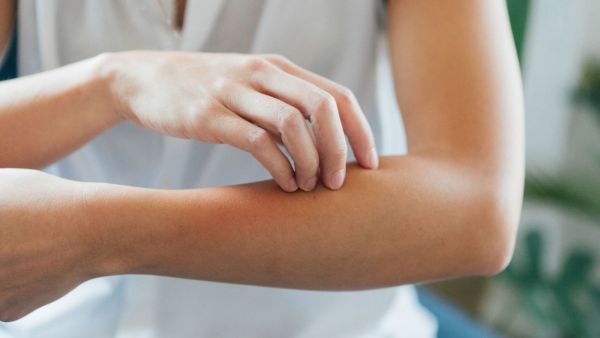 Why do skin allergies and fungal infections increase during rainy season? How to rescue