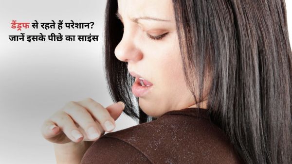 Do you bother dandruff even in summer? Learn the science behind it