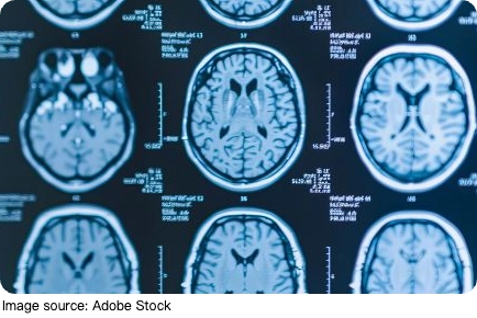 The Truth Behind Parkinson’s