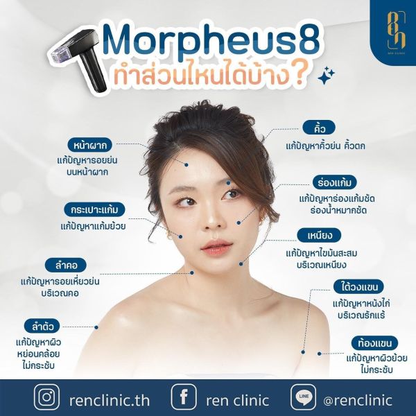Morpheus8 ช่วยอะไร
