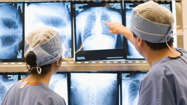 World Lungs Cancer Day: What is the difference between symptoms of lung cancer and TB, learn from experts